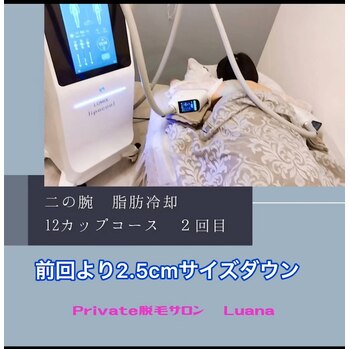 脂肪冷却でサイズダウン