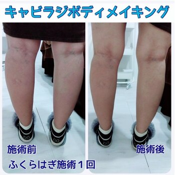 キャビラジボディメイキング
