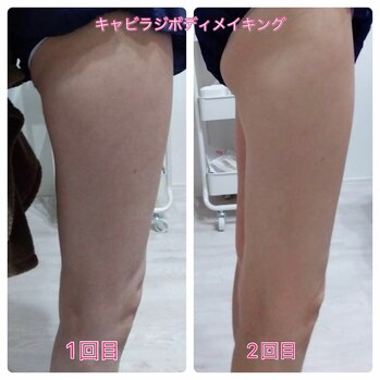 lipocool