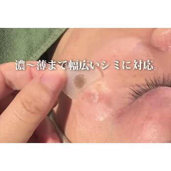 本気のシミケア商品導入